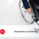 Amputatia si diabetul