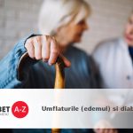 Umflaturile (edemul) si diabetul – umflaturi la nivelul picioarelor, gleznelor si talpilor