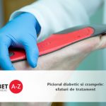 Piciorul diabetic si crampele: sfaturi de tratament