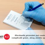 Afectiunile piciorului pot conduce la complicatii grave, atrag atentia specialistii