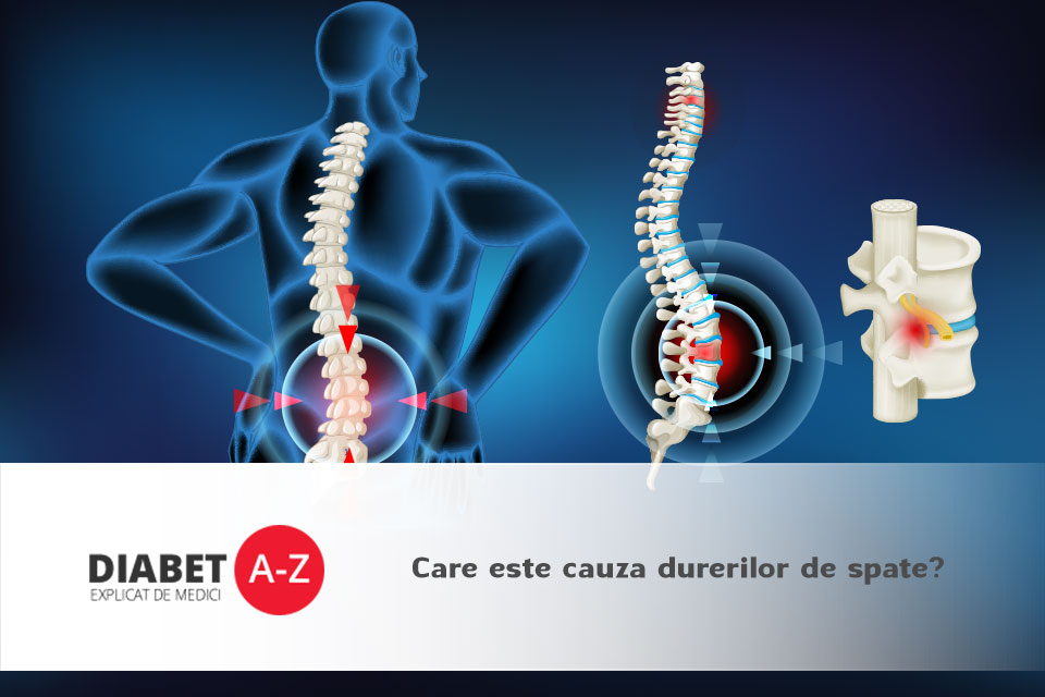 tratamentul spatelui și coloanei vertebrale osteoartrita de gradul 2 a genunchiului