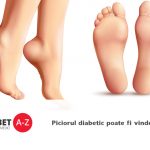 Piciorul diabetic poate fi vindecat?