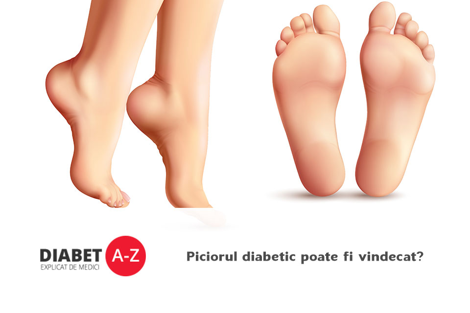 articulațiile picioarelor cu diabet