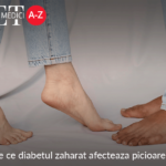 De ce diabetul zaharat afecteaza picioarele?