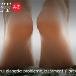 Piciorul diabetic: probleme, tratament si preventie