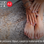 Durerea de picioare: tipuri, cauze si tratament la domiciliu (I)